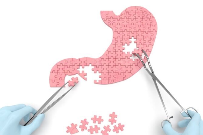 جراحات السمنة| Obesity surgeries